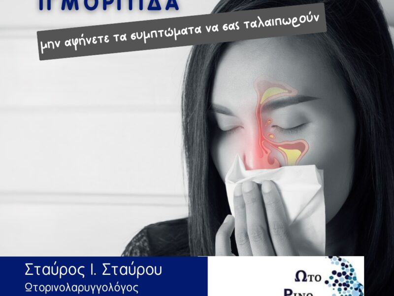Ιγμορίτιδα